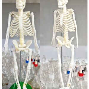 Human skeleton in sri lanka